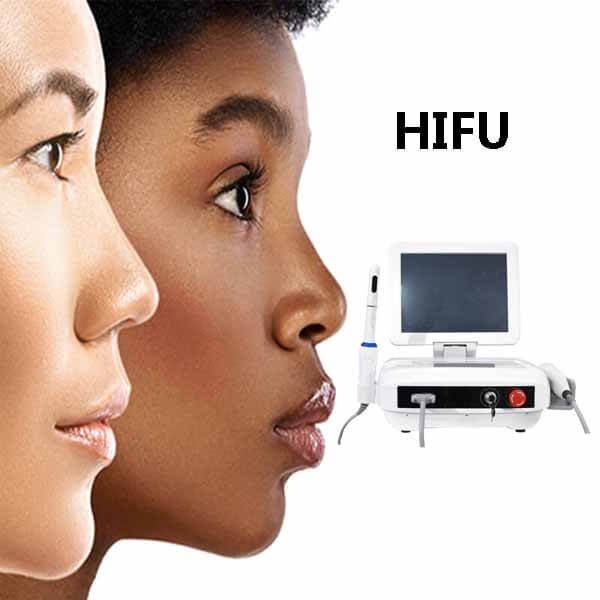 HIFU machine treatment for skin lift