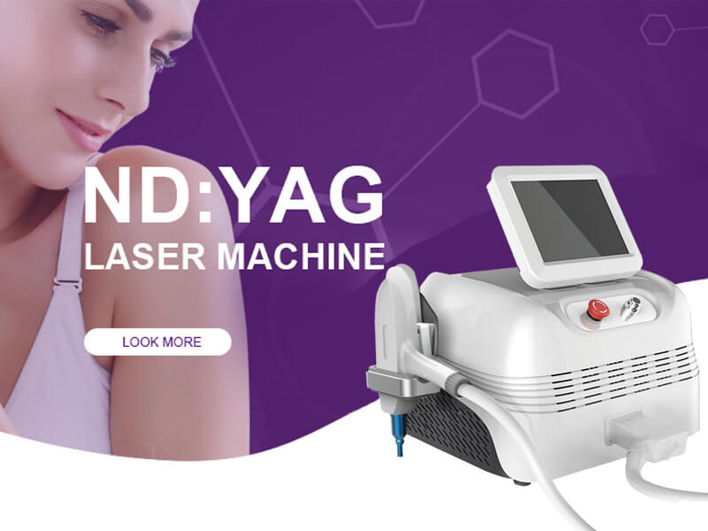 nd yag laser machine birthmark removal