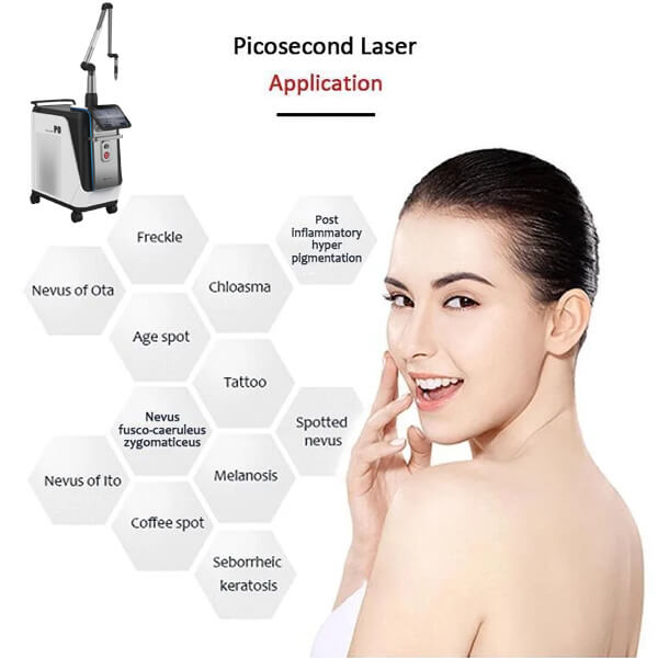 Picosecond laser for hyperpigmentation removal