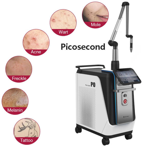 Picosecond laser sessions results