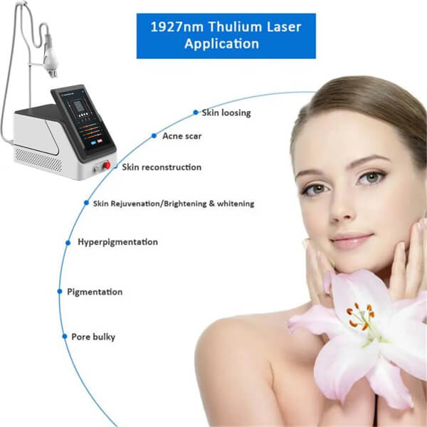 Fractional thulium laser machine for acne scar removal