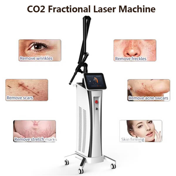 The benefits of CO2 fractional laser procedure compared to other treatment