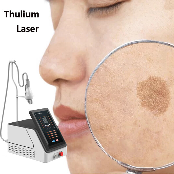 Thulium Laser in the Treatment of Pigmentation: An Innovative Approach in Dermatology